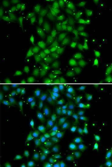 Anti-UBE2Z Antibody
