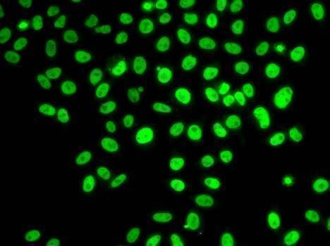 Anti-POLD3 Antibody