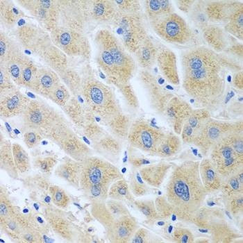 Anti-BLVRB Antibody