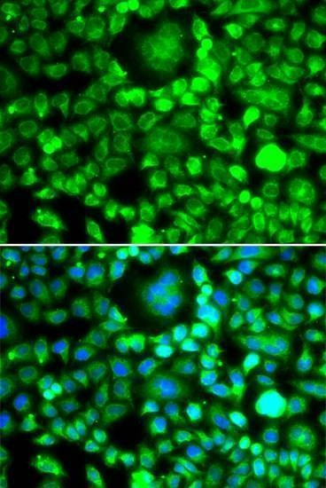 Anti-BLID Antibody