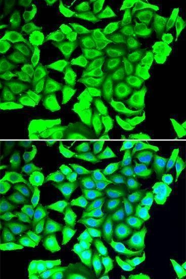 Anti-DCD Antibody