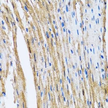 Anti-GOLM1 Antibody