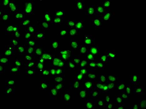Anti-HMG20A Antibody