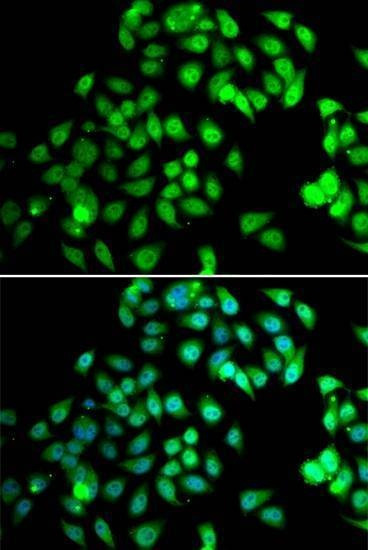 Anti-NCBP2 Antibody