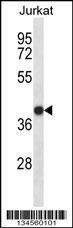 Anti-SET (N-term) Antibody