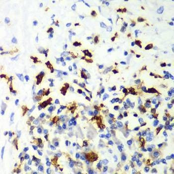 Anti-CAPG Antibody