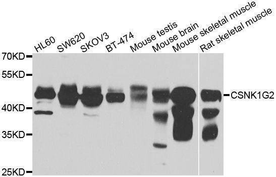 Anti-CSNK1G2 Antibody