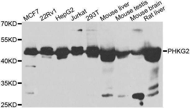 Anti-PHKG2 Antibody