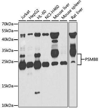 Anti-PSMB8 Antibody