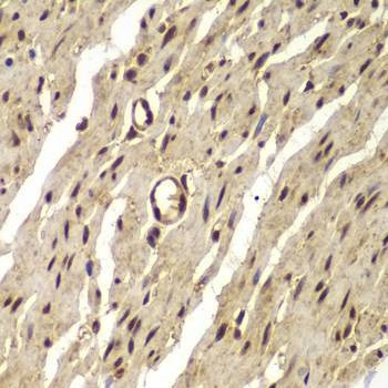 Anti-PSMB8 Antibody