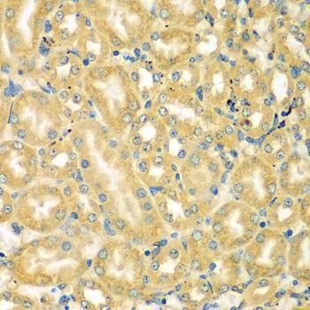 Anti-MOCS3 Antibody