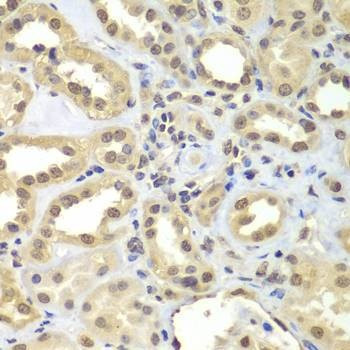 Anti-SUPT20H Antibody