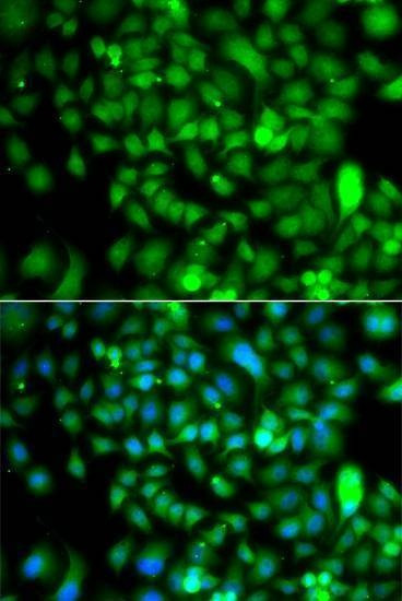 Anti-CSRP2BP Antibody