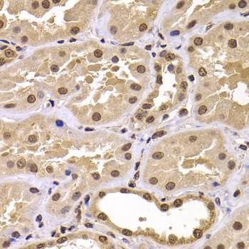 Anti-CSRP2BP Antibody