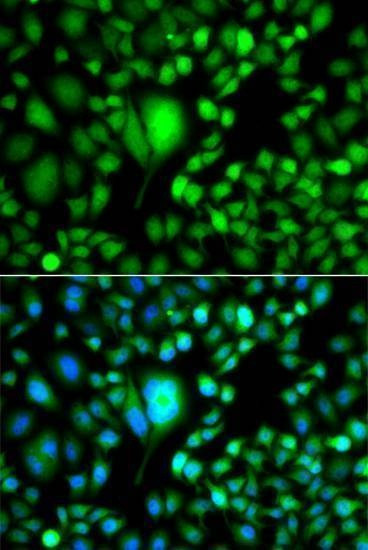 Anti-CSRP2BP Antibody