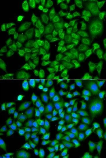 Anti-NAA50 Antibody