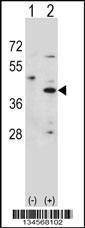 Anti-HSD3B1 (N-term) Antibody