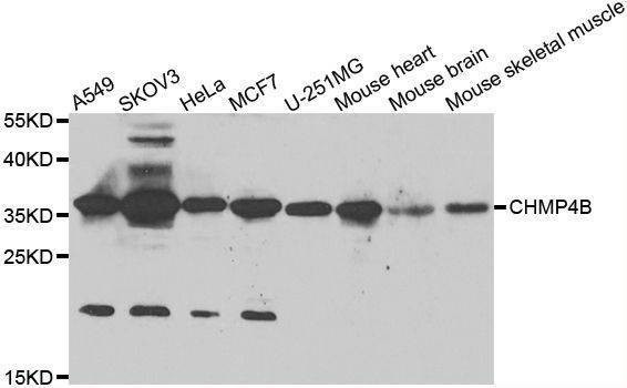 Anti-CHMP4B Antibody