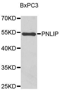 Anti-PNLIP Antibody