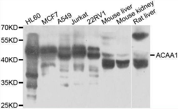 Anti-ACAA1 Antibody
