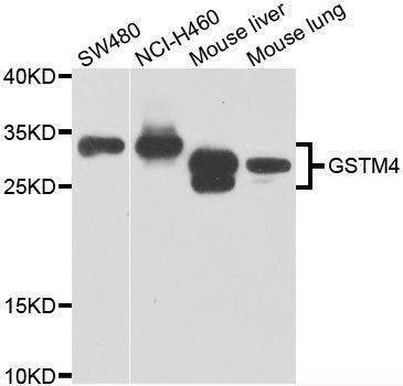 Anti-GSTM4 Antibody