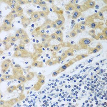 Anti-SHBG Antibody