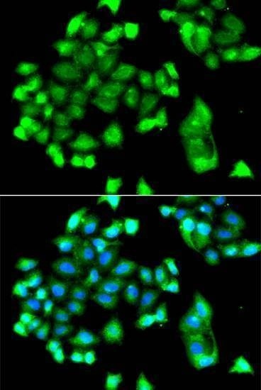Anti-FBXO7 Antibody
