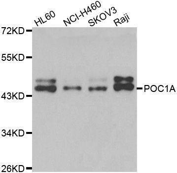 Anti-POC1A Antibody