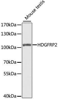 Anti-HDGFRP2 Antibody