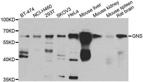 Anti-GNS Antibody
