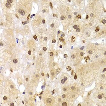 Anti-HNRNPA1 Antibody