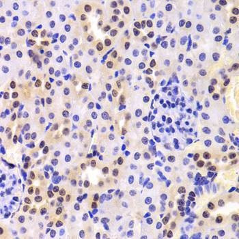 Anti-HNRNPA1 Antibody