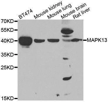 Anti-MAPK13 Antibody