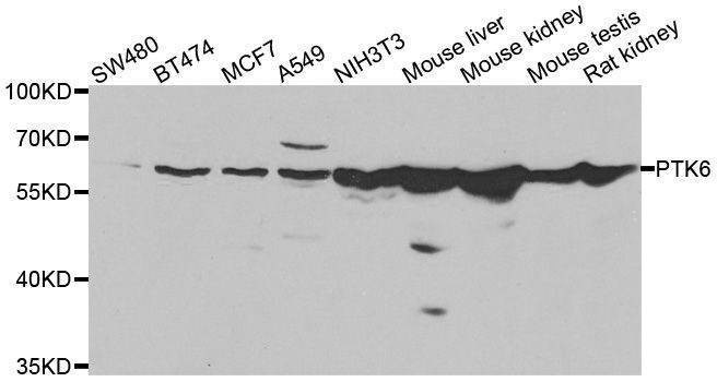 Anti-PTK6 Antibody