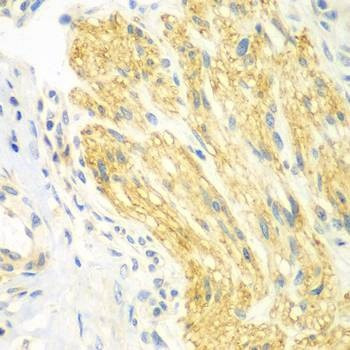 Anti-PTK6 Antibody