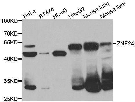 Anti-ZNF24 Antibody