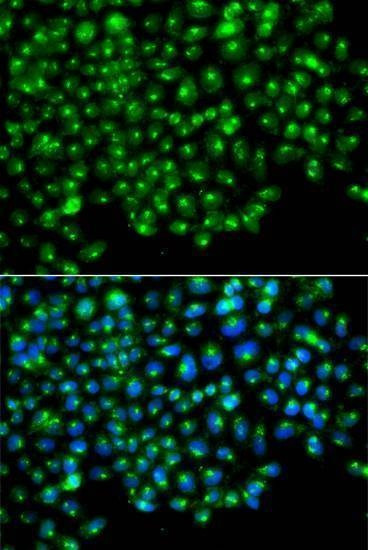 Anti-GOPC Antibody