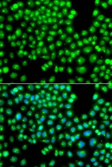 Anti-GOPC Antibody
