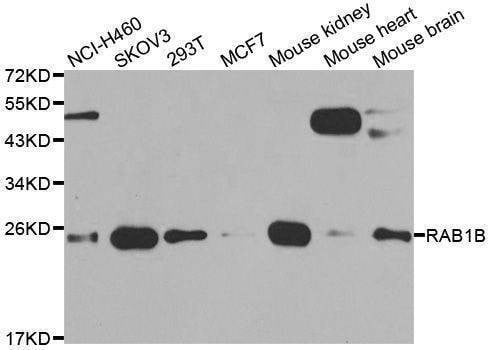 Anti-RAB1B Antibody