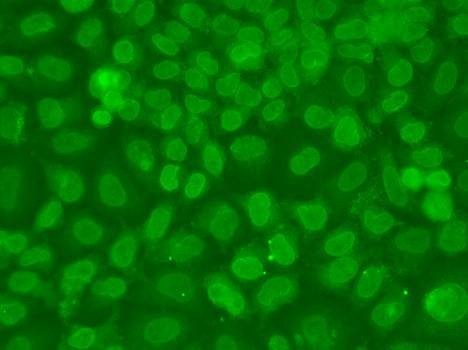 Anti-TARBP2 Antibody