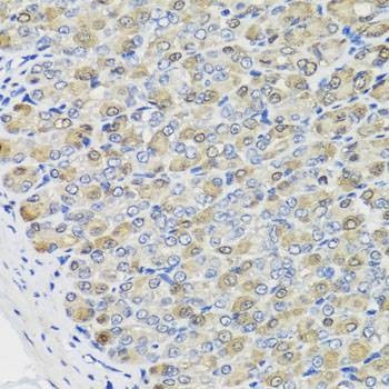 Anti-CBR3 Antibody