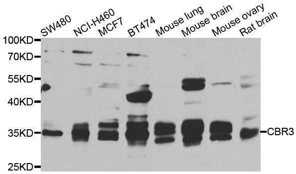 Anti-CBR3 Antibody