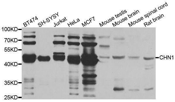 Anti-CHN1 Antibody