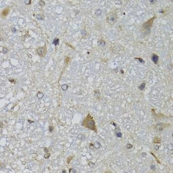 Anti-CHN1 Antibody