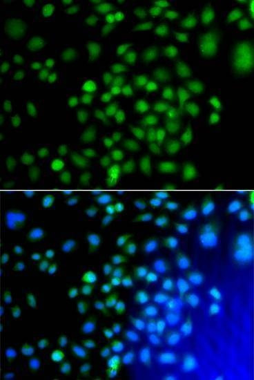 Anti-ATF7 Antibody