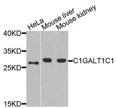 Anti-C1GALT1C1 Antibody