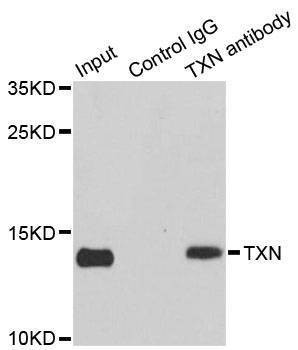 Anti-TXN Antibody