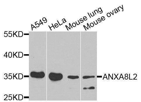 Anti-ANXA8L2 Antibody