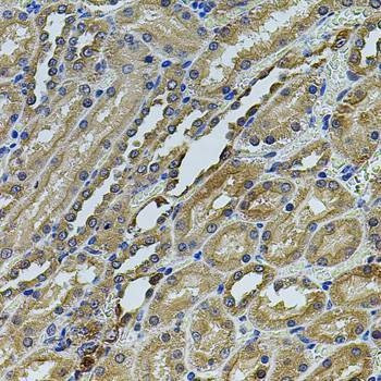 Anti-ANXA8L2 Antibody