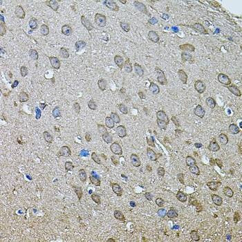 Anti-ANXA8L2 Antibody